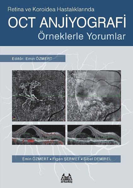 Retina ve Koroidea Hastalıklarında OCT Anjiyografi  Örneklerle Yorumlar